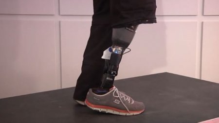 Dünyada bir ilk - hiss edilən protez