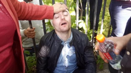 Polis Yerevanda etirazçıların deputat liderini döyüb xəstəxanalıq etdi